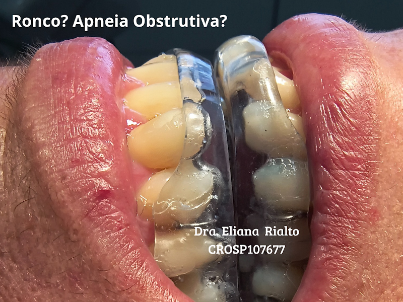 Foto 3 de Dra. Eliana Rialto - Especialista Ortodontia /Aparelhos Ronco/Apneia /ATM/Dor Orofacial/ Laserterapia/ Harmonização Facial