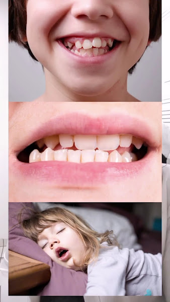 Foto 3 de Dra. Eline Costa Brites | Especialista em ortodontia e dentística