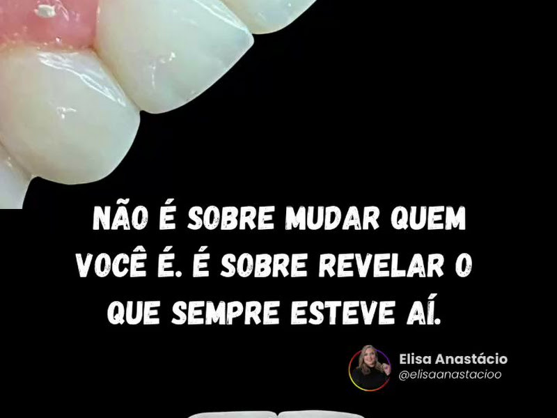 Foto 4 de Dra. Elisa Anastácio - Dentista | Facetas | Olinda