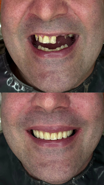 Foto 4 de Dra Elisabete Rabuske- Sedação para Pacientes com medo, fobia e trauma, Lentes/Próteses Fixas/Implantes/Clínico