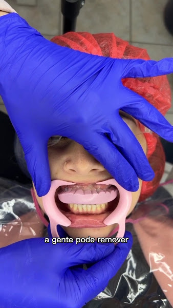 Foto 5 de Dra Elisabete Rabuske- Sedação para Pacientes com medo, fobia e trauma, Lentes/Próteses Fixas/Implantes/Clínico