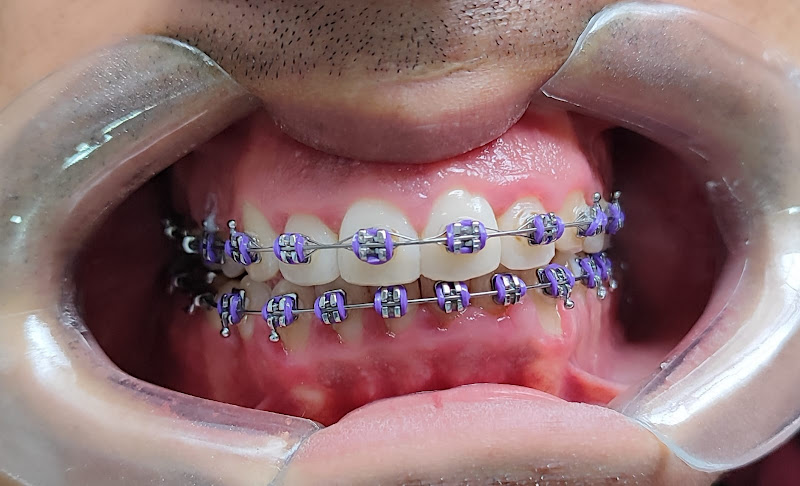 Foto 2 de Dra.Elisangela N.Lopes Cirurgiã Dentista Santo André