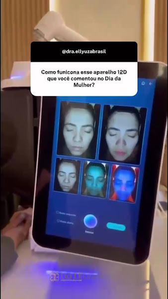 Foto 3 de Dra. Ellyuza Brasil - Especialista em Harmonização Facial e Estética Dental