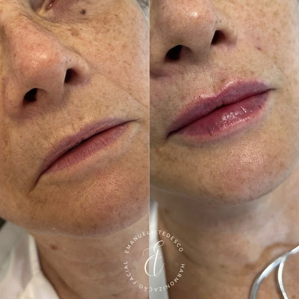 Foto de Dra Emanuele Tedesco Harmonização Facial