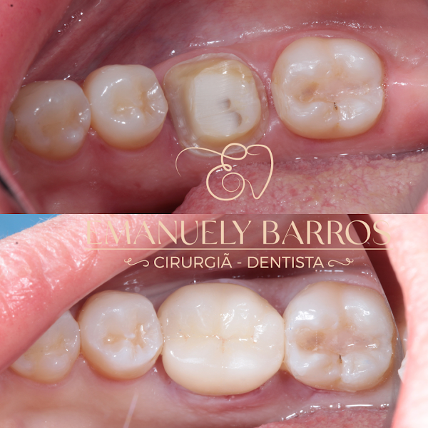 Foto 3 de Dra Emanuely Barros - Dentista Campo Grande MS