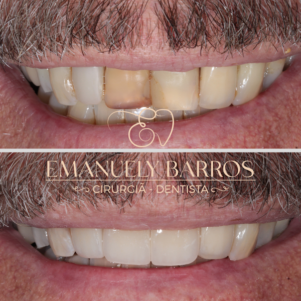 Foto 4 de Dra Emanuely Barros - Dentista Campo Grande MS
