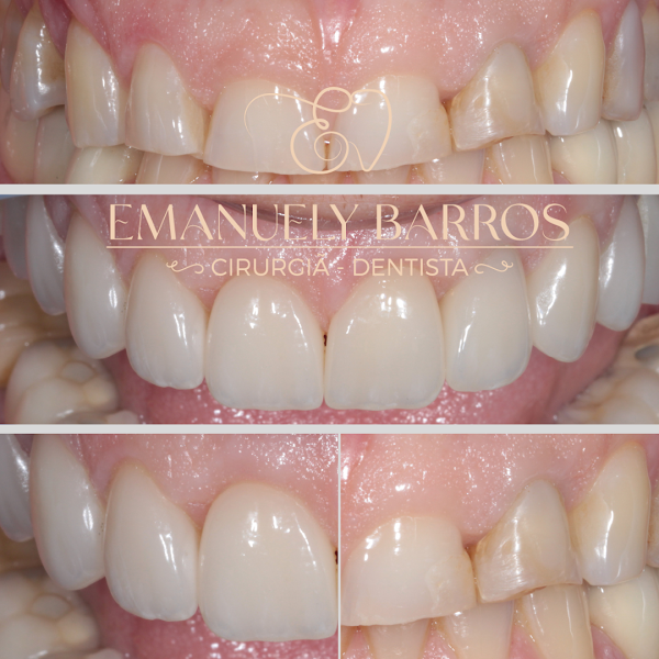 Foto 5 de Dra Emanuely Barros - Dentista Campo Grande MS