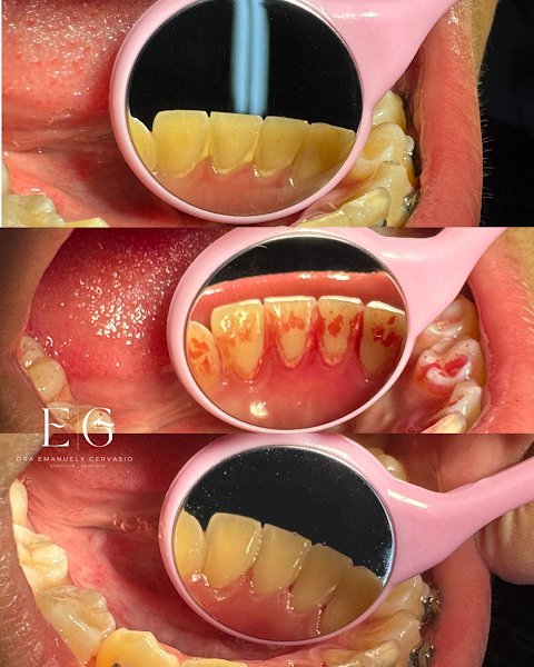 Foto 2 de Dra. Emanuely Gervasio - dentista em Ipatinga MG / Clareamento dental / Aparelho invisível / Laserterapia