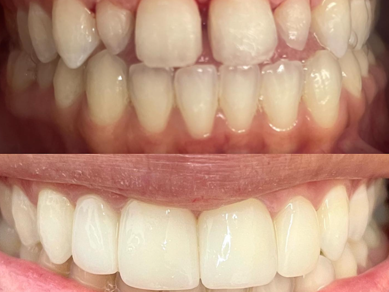 Foto de DRA.EMILIA CRISTINA/ PROFESSORA ESPECIALISTA EM HARMONIZAÇÃO FACIAL E ODONTOLOGIA SÃO PAULO