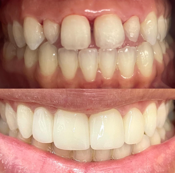 Foto 3 de DRA.EMILIA CRISTINA/ PROFESSORA ESPECIALISTA EM HARMONIZAÇÃO FACIAL E ODONTOLOGIA SÃO PAULO