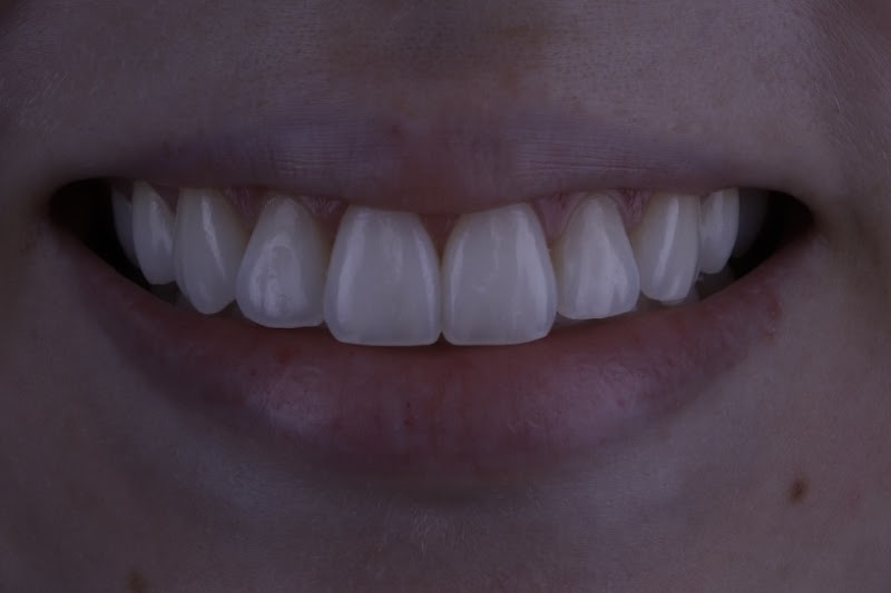 Foto 2 de Dra. Emilly Oliveira - Dentista Petrolina