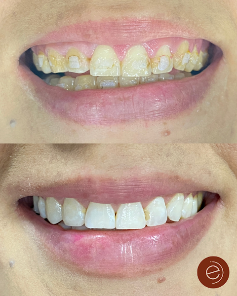 Foto 3 de Dra. Emilly Oliveira - Dentista Petrolina