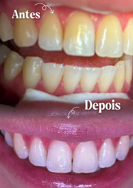 Foto 2 de Dra. Emmanuelle Aldred | Cirurgiã-Dentista