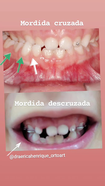 Foto 2 de Dra. Erica Henrique - Consultório Odontológico