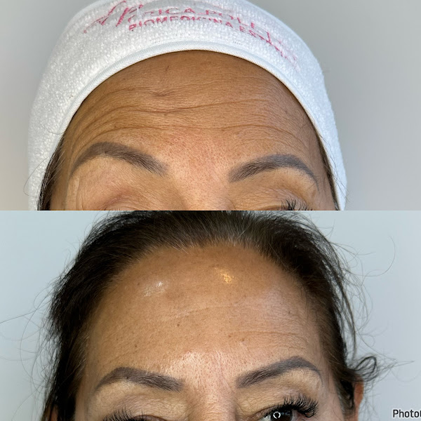 Foto 3 de Dra Erica Poletto Estética Avançada