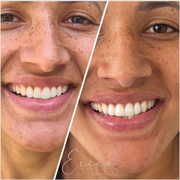 Foto 3 de Dra. Érica Sales