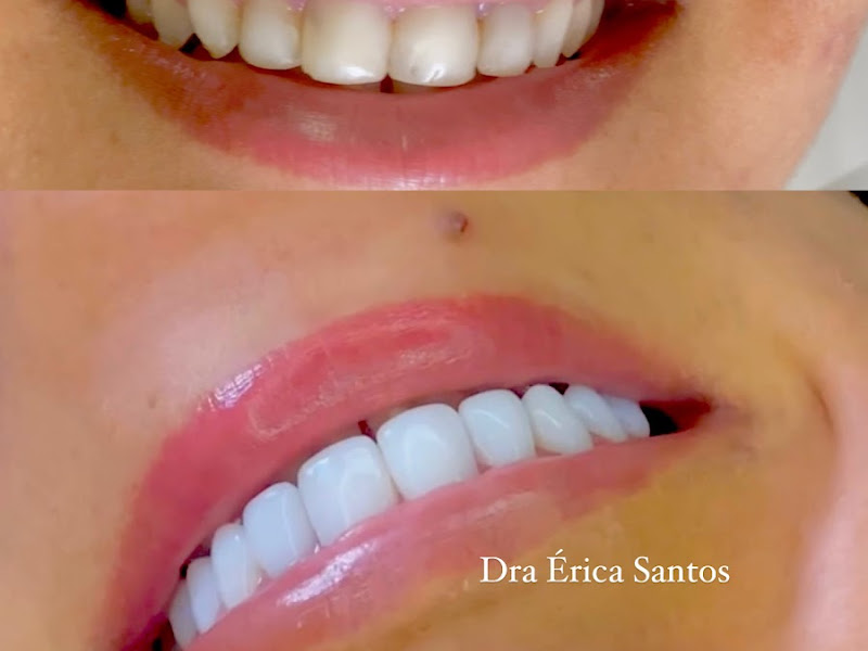 Foto 2 de Dra Èrica Santos