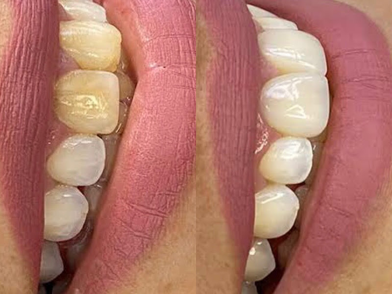 Foto 4 de Dra Èrica Santos