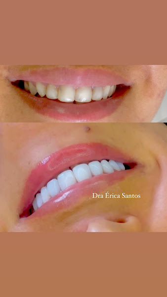 Foto 5 de Dra Èrica Santos
