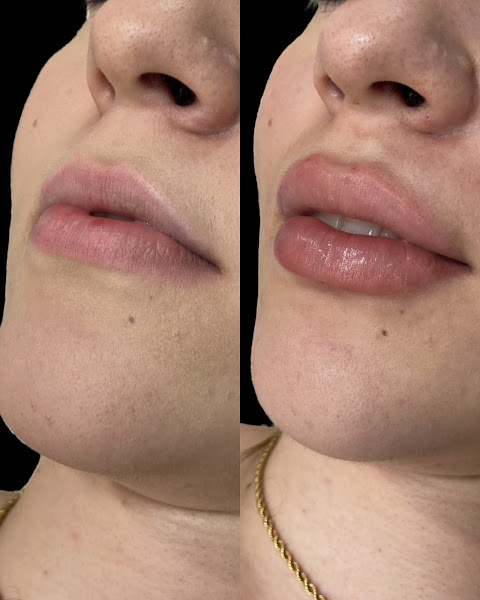 Foto 3 de Dra. Érica Xavier - Harmonização Orofacial e Odontologia