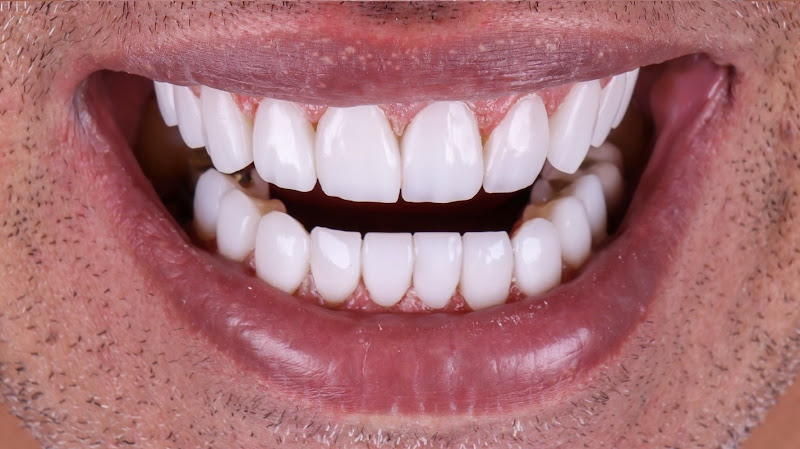 Foto 2 de Dra Érida Ellen Odontologia e Harmonização Orofacial