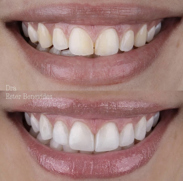 Foto 2 de Dra Ester Benevides Odontologia