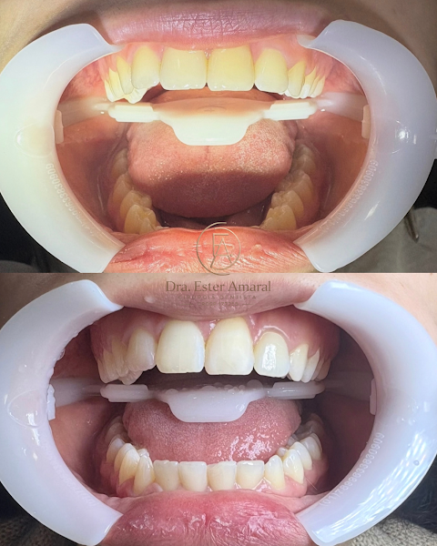 Foto 3 de Dra. Ester Garcia Amaral- Cirurgiã Dentista