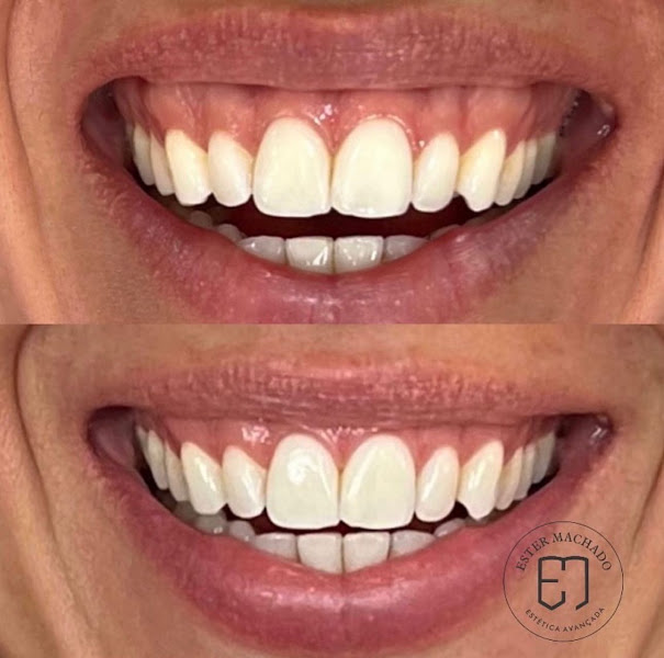 Foto 2 de Dra. Ester Machado - Especialista em Harmonização Facial - Sinop-MT