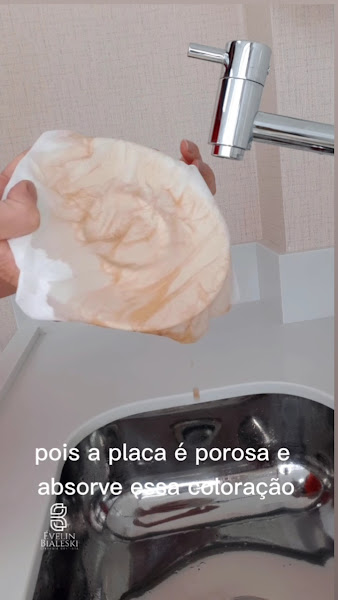 Foto 3 de Dra Évelin Bialeski Odontologia Especializada - Lentes de contato / implantes / protocolo