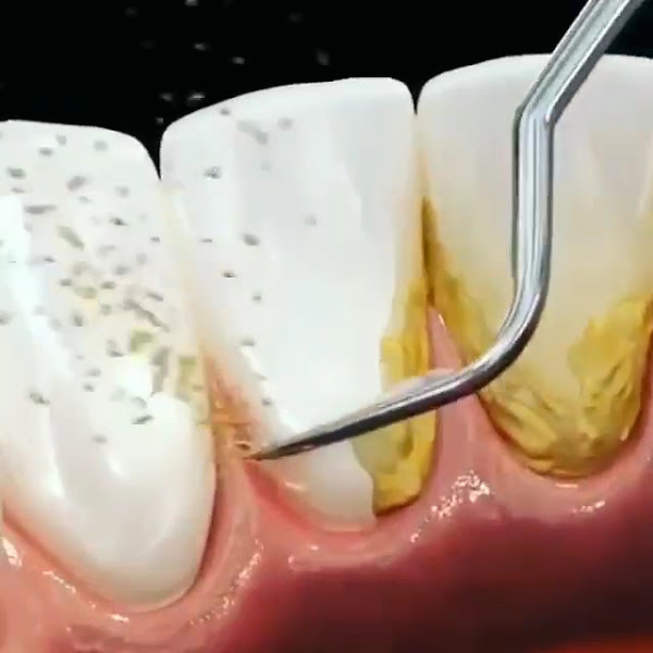 Foto 3 de Dra Fábia Zampieri D'Antola de Mello - Harmonização Orofacial