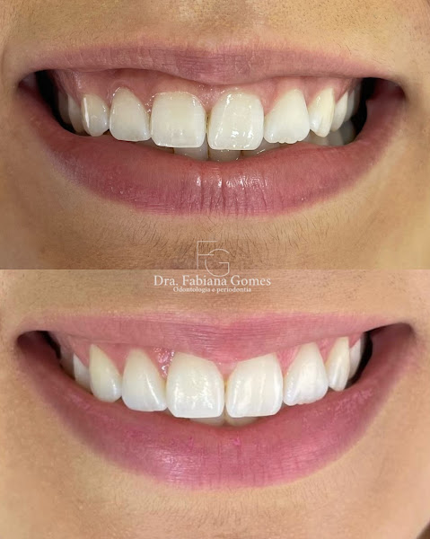 Foto 2 de Dra Fabiana Gomes | Odontologia & Periodontia