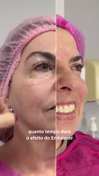 Foto 3 de Dra. Fabiana Guedes - Harmonização Facial em Itapetininga