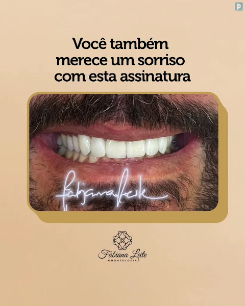 Foto 4 de Dra. Fabiana Nunes Leite - Facetas de resina em Petrolina | Periodontista em Petrolina