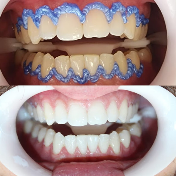 Foto 2 de Dra. Fabiana Paiola Odontologia Estética - Implantes dentários e Facetas em Ribeirão Preto - SP