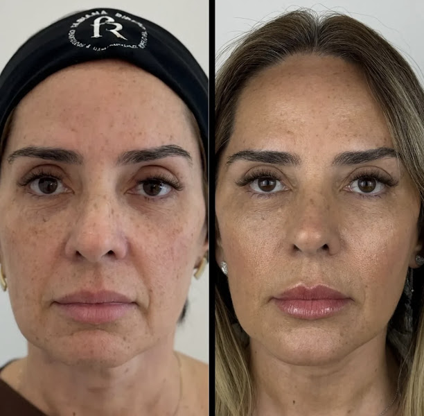 Foto 2 de Dra Fabiana Ribeiro - Odontologia Estética e Harmonização Orofacial