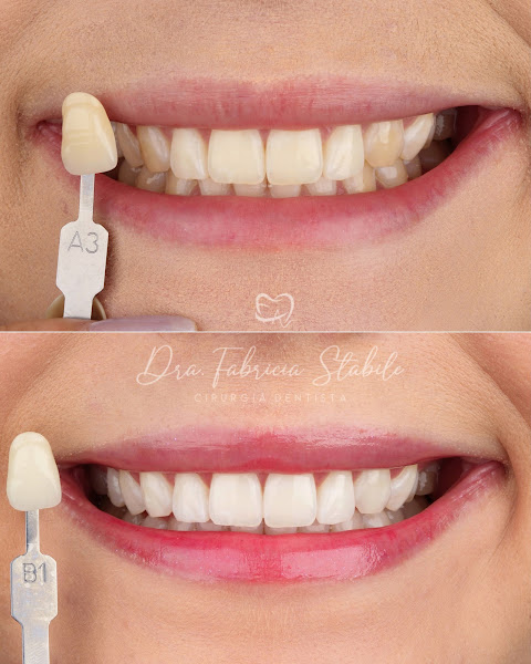 Foto 2 de Dra. Fabricia Stabile | Dentista em São José dos Campos |