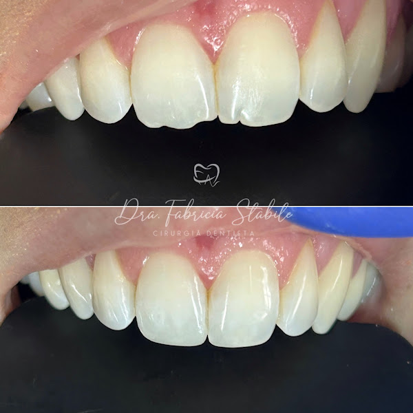 Foto 3 de Dra. Fabricia Stabile | Dentista em São José dos Campos |