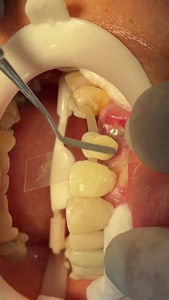 Foto 3 de Dra. Fátima Neves especialista em prótese - Dentista - Clínica sorrir