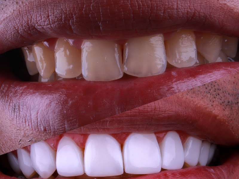 Foto 9 de Dra. Fátima Neves especialista em prótese - Dentista - Clínica sorrir