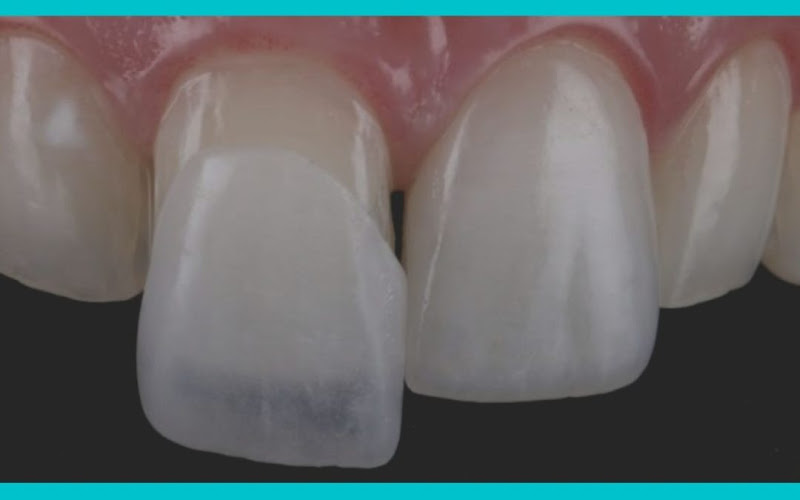 Foto 3 de Dra. Fernanda Cabral - Clinica Odontologica