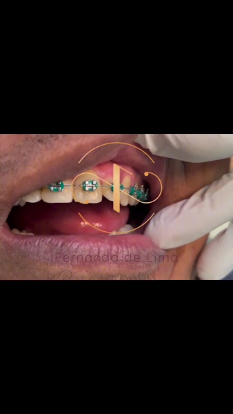 Foto 4 de Dra Fernanda de Lima Odontologia | Ortodontia em Teresina