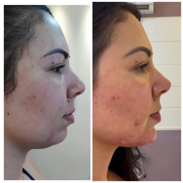Foto 3 de Dra. Fernanda França - Harmonização Facial e Corporal