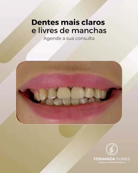 Foto 3 de Dra. Fernanda Gomes - Ortodontista em Areias, Recife - PE | Implantes dentários em Areias, Recife - PE
