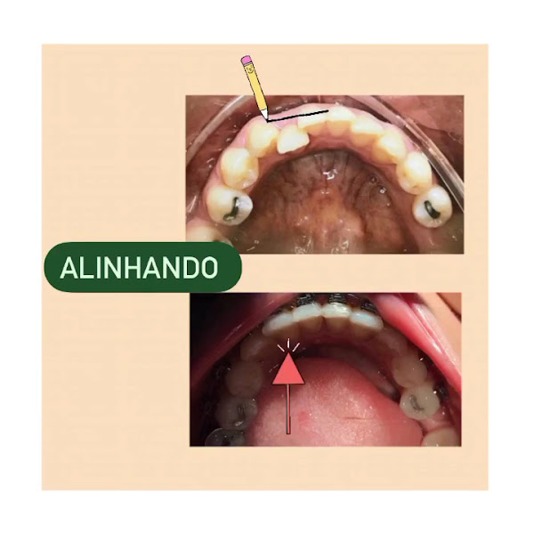 Foto 3 de DRA. FERNANDA GONÇALVES ORTODONTIA E ODONTOLOGIA