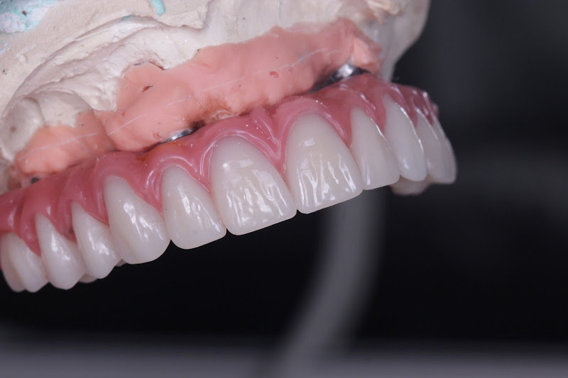 Foto 5 de DRA. FERNANDA GUSMÃO | VIVAZ ODONTO | IMPLANTE E PROTESE