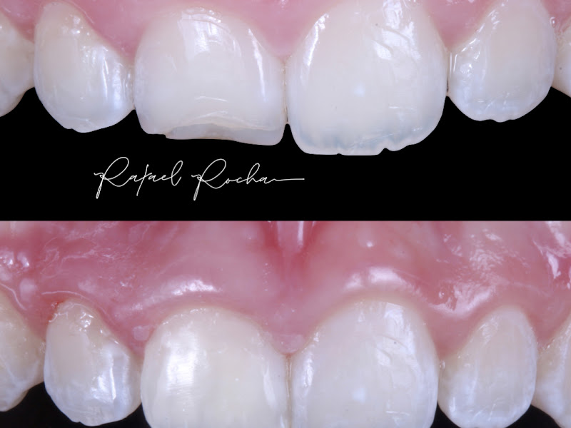 Foto 12 de Dra. Fernanda Herrera Cirurgiã Dentista - São José dos Campos