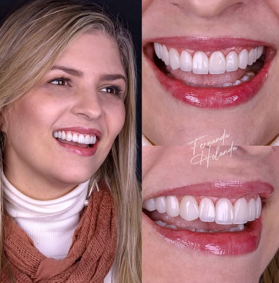 Foto 3 de Dra Fernanda Holanda Odontologia Estética