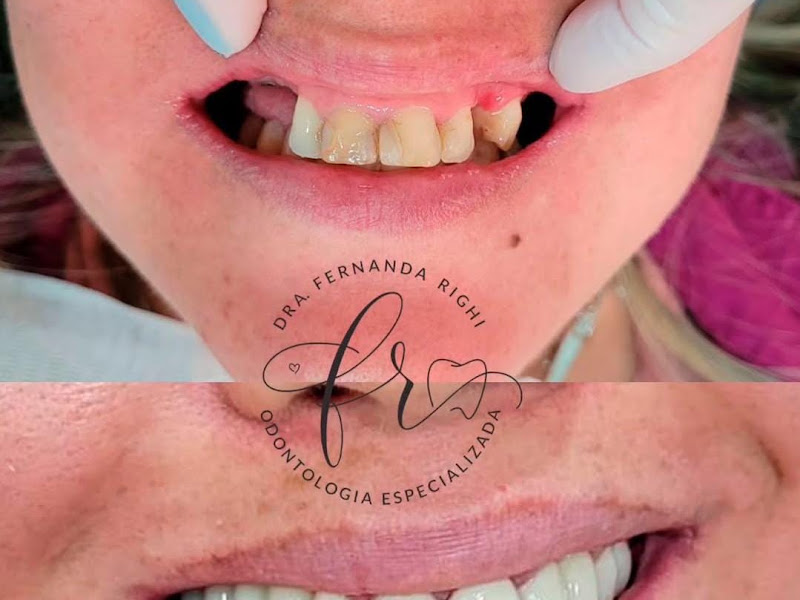 Foto 3 de Dra Fernanda Kolling | Cirurgiã-Dentista
