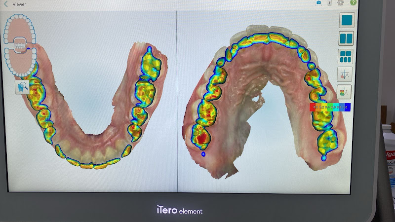 Foto 3 de Dra Fernanda Lima - Endodontia (Tratamento de Canal)