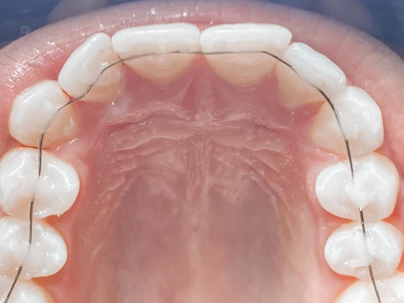 Foto 9 de Dra Fernanda Lima - Endodontia (Tratamento de Canal)